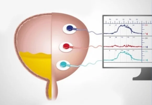 Estudo Urodinâmico em Araranguá: o que é, para que serve e onde fazer com segurança